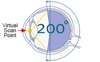 Optomap retinal exam