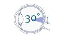 Traditional retinal exam